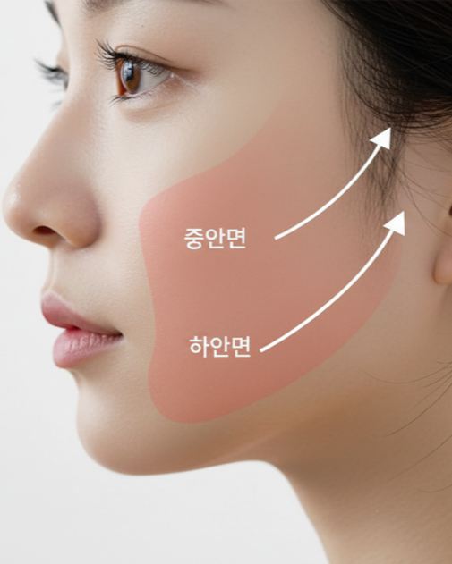 수술 후 얼굴 45도 사진 - 리프팅된 얼굴선