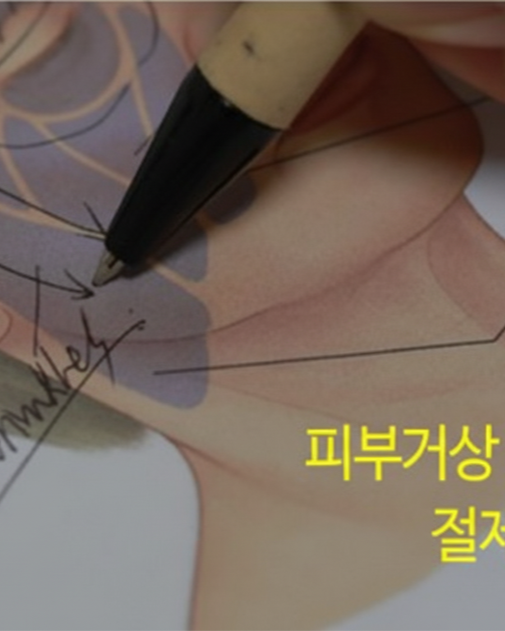 수술 후 얼굴 90도 사진 - 리프팅된 얼굴선