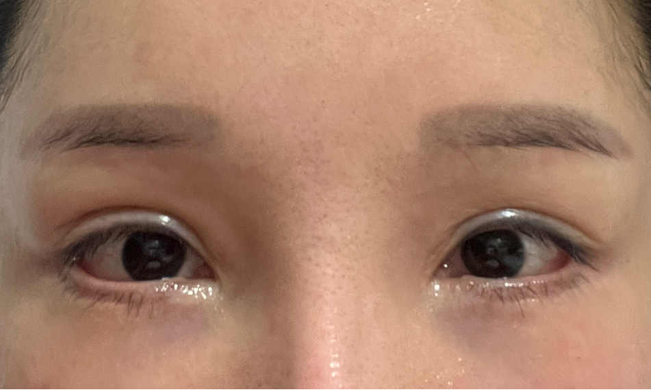 이지윤 님의 리얼모델 신청입니다. 접수일 2024-03-09 19:50:23 