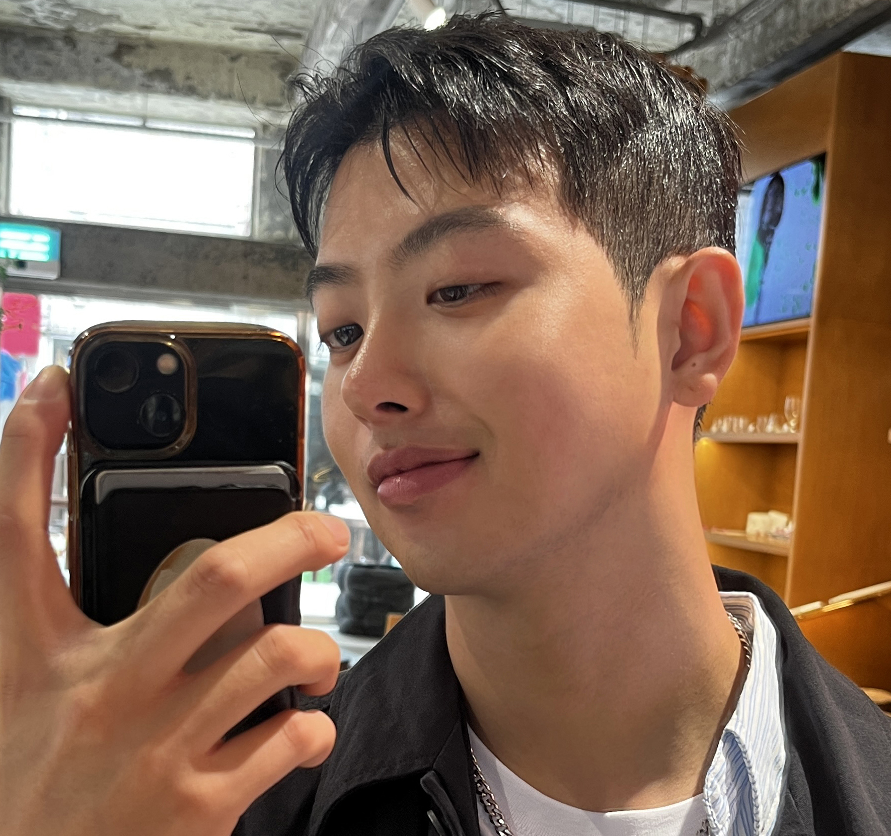 무보형물 코수술+이마축소 후기올려요