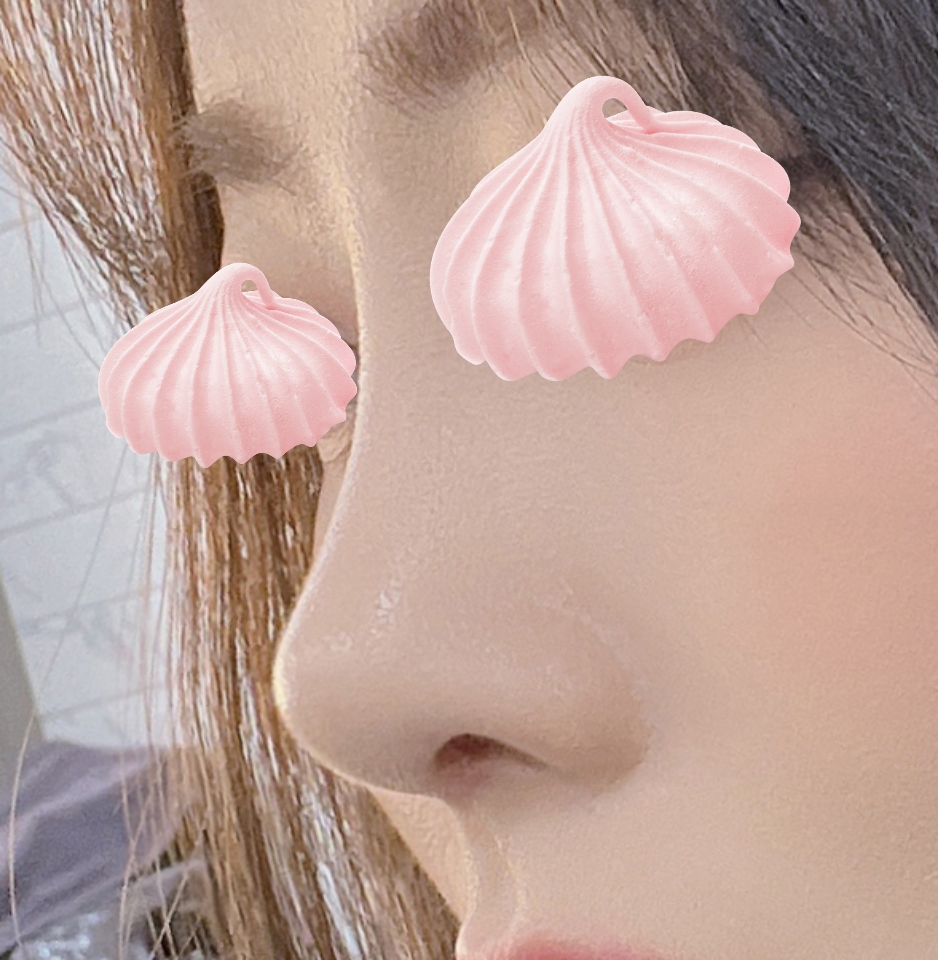 지인소개로 바이브에서 수술받았어용