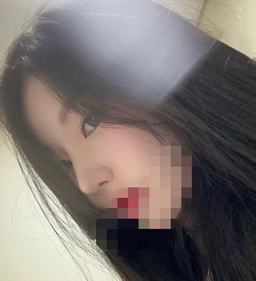 첫코+쌍수 재수술 4개월차!