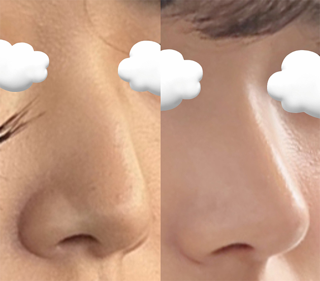 유원장님 완전 섬세하시고 수술 잘하셔용