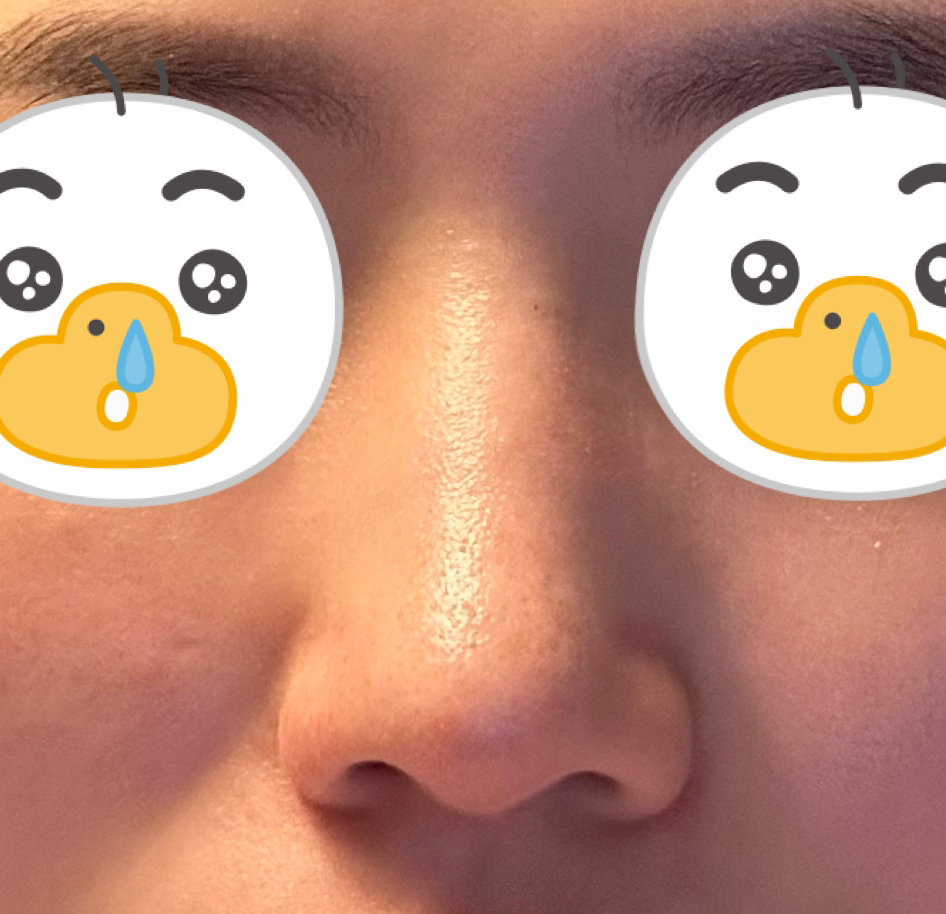 저와 너무 어울리는 코ㅎㅎ