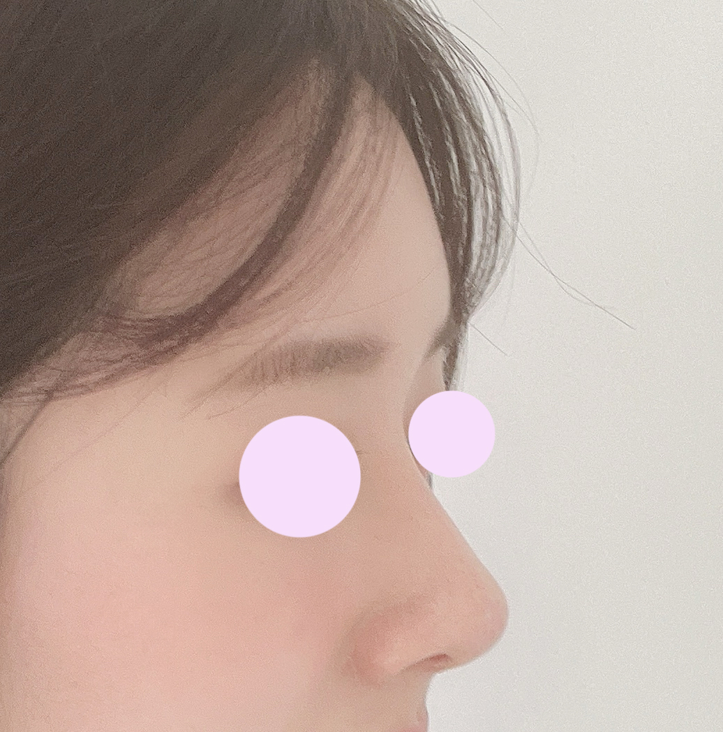 제 인생 첫수술! 바이브에서 했습니다:)