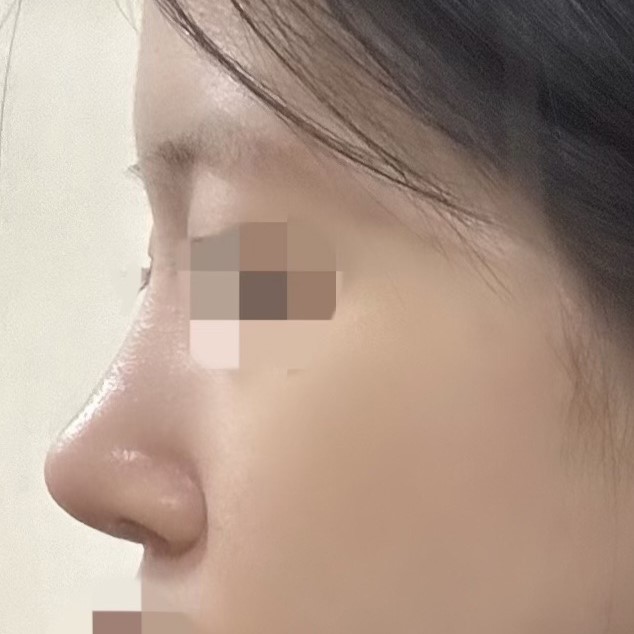 바이브 성형외과 추천입니다 !!