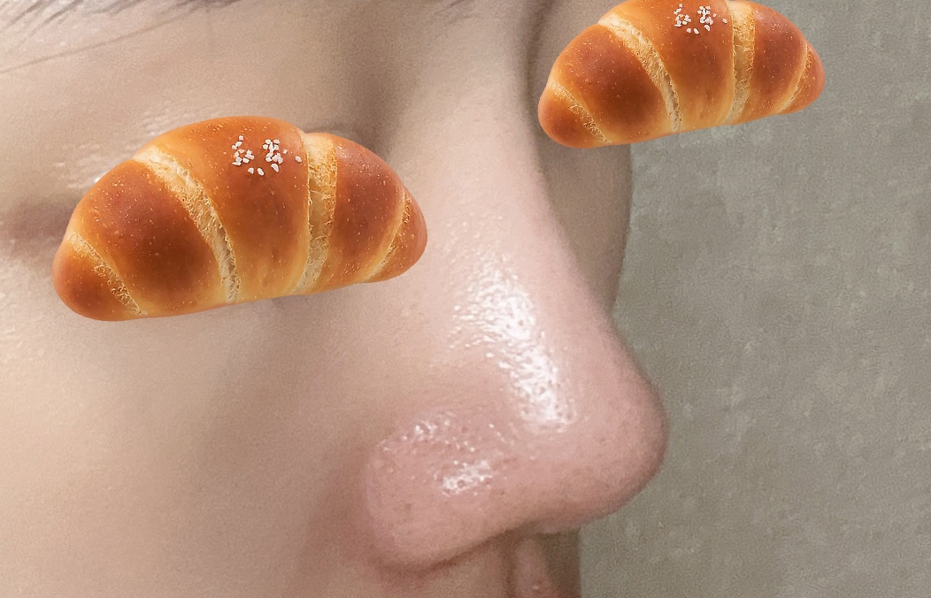 복코+짧은코교정 4개월됐네용