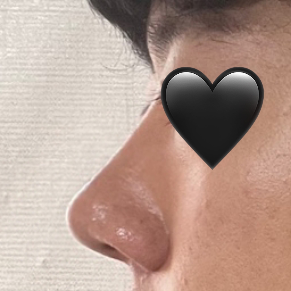 원장님 덕분에 새 얼굴을 가지게 된 거 같아요