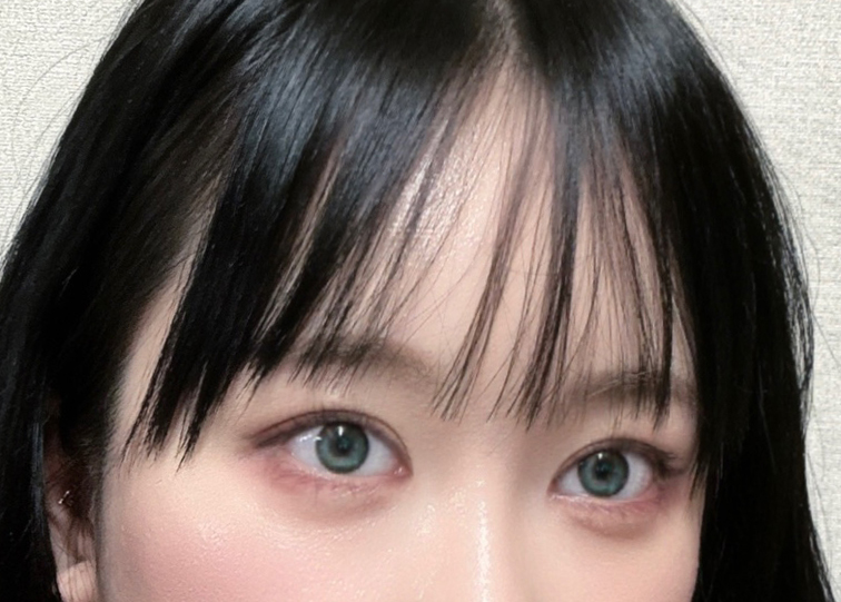 쌍수재수술, 이마거상, 얼지흡, 심부볼 다했네요