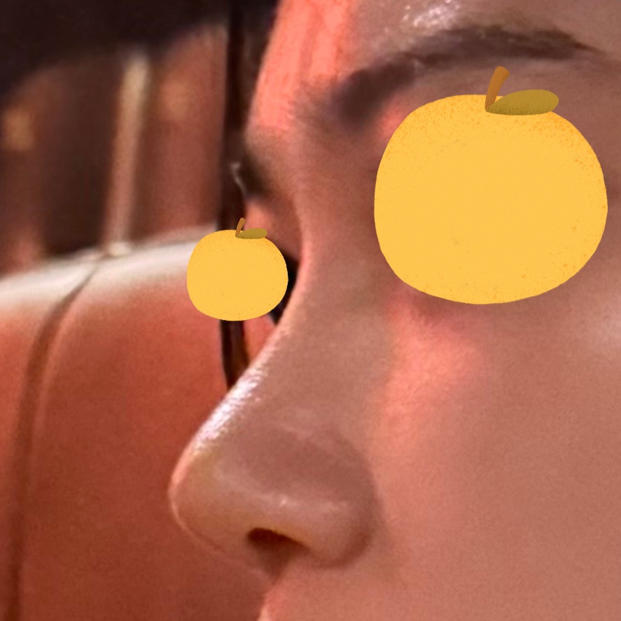 코수술 하길 너무 잘했어요 !