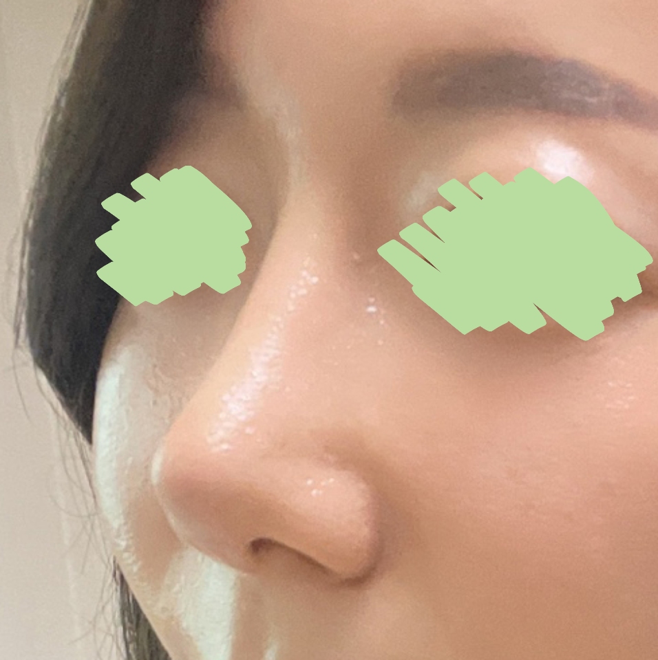 유영문원장님 손기술 최고 ㅎㅎ