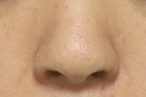 비공내리기 교정 잘 된거같아서 만족합니다