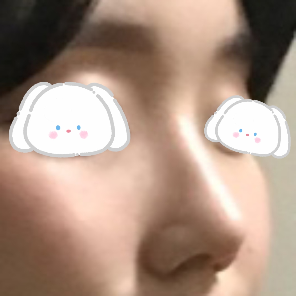 자연스럽고 예쁜 코로 만들어주셔서 감사합니다 !