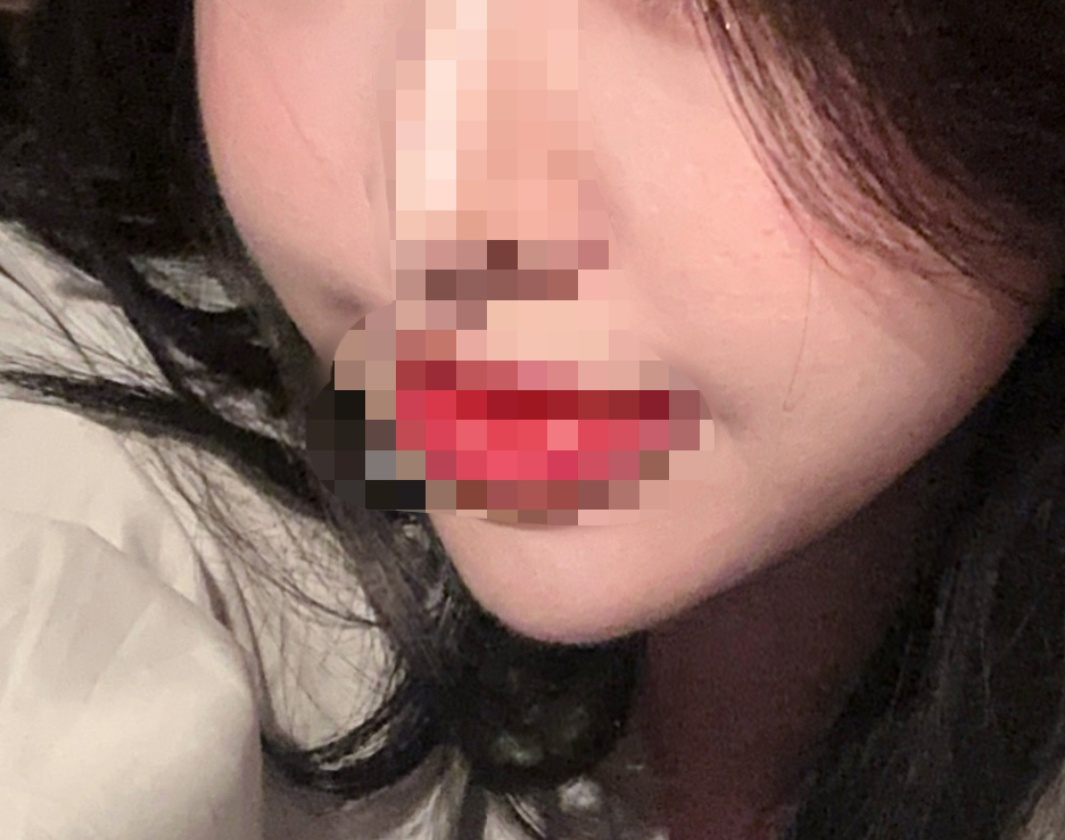 절개없이 얼지흡해써요 대박만족