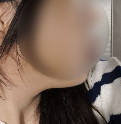 동글동글 턱라인 날렵!!