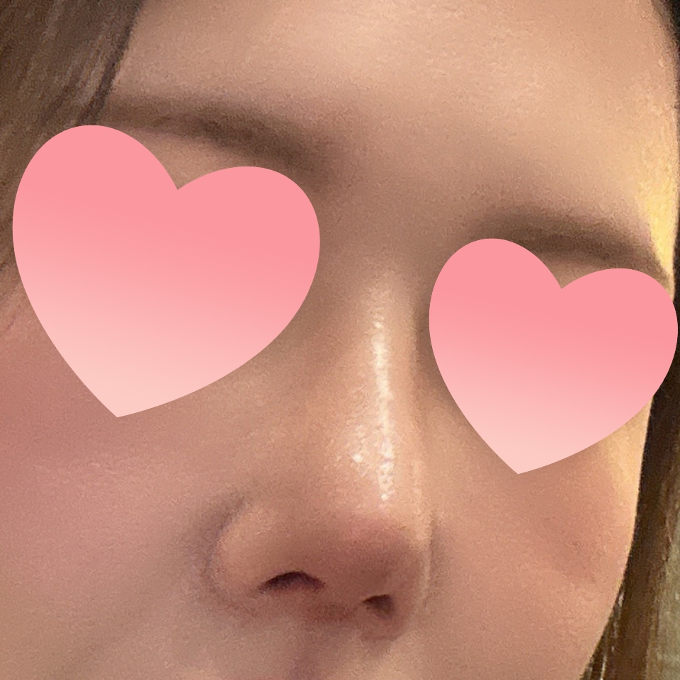 만족스러운 코 후기!