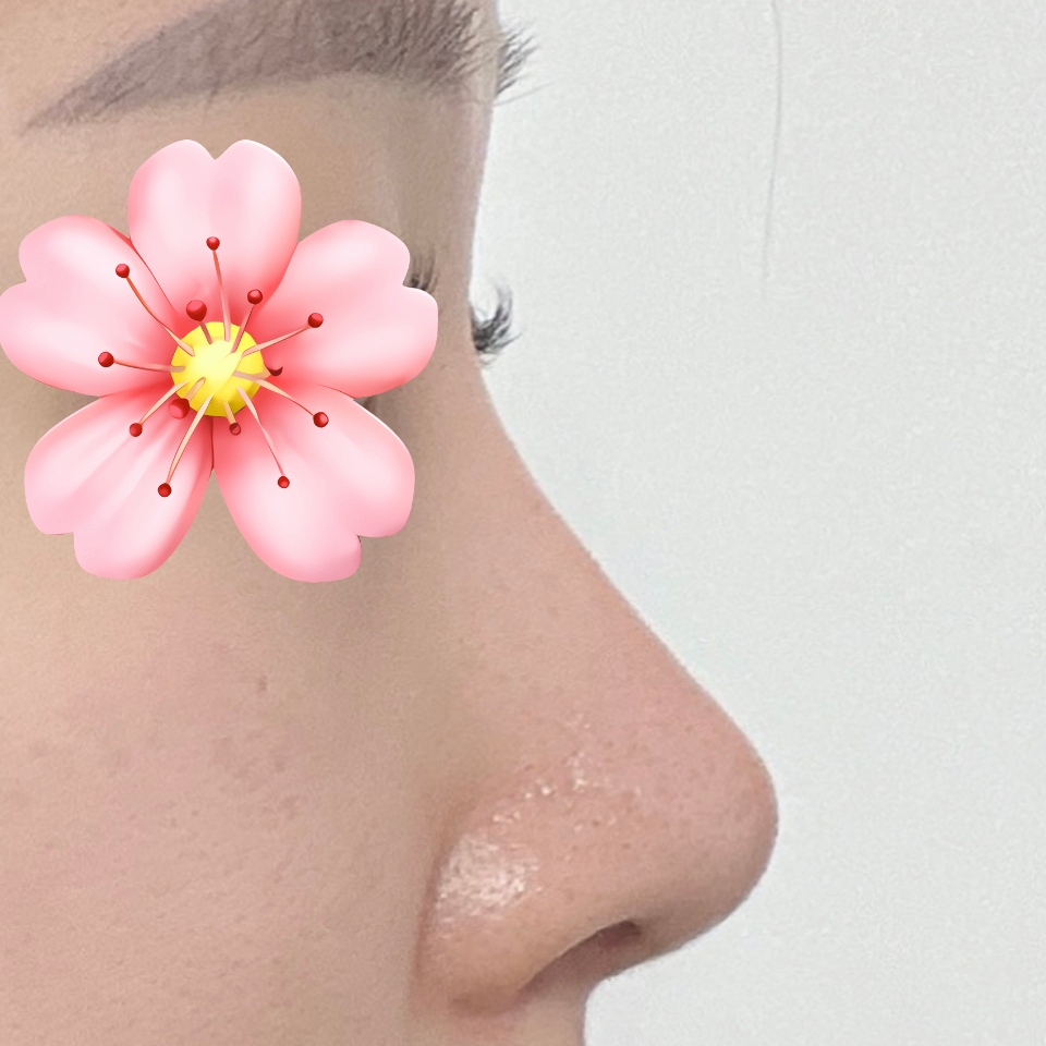 다시 돌아가도 유영문 원장님께 수술 받을거예요 !