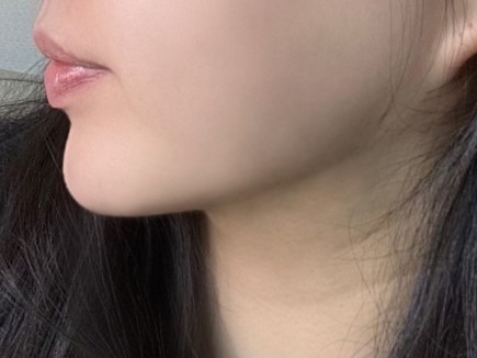 이제 다이어트 안해용 !!