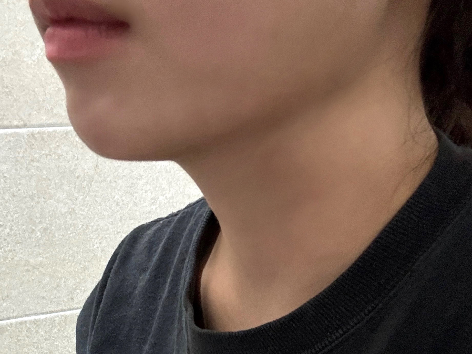 이중턱 고민이신분들은 바이브 추천합니다