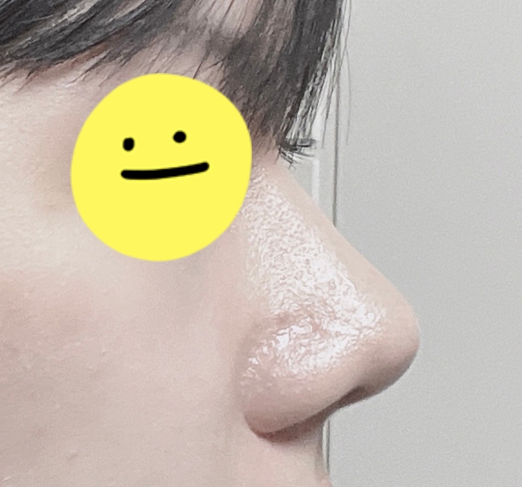 눈, 코했는데 주변에서 잘됐다하네욤!