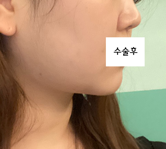 수술후_1_.jpg