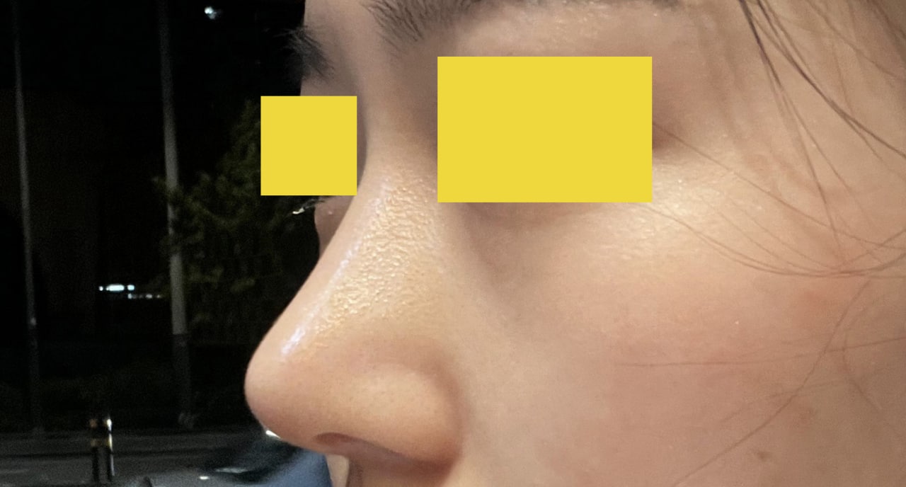 이쁜 코와 눈매로 잘 지내고 있어요