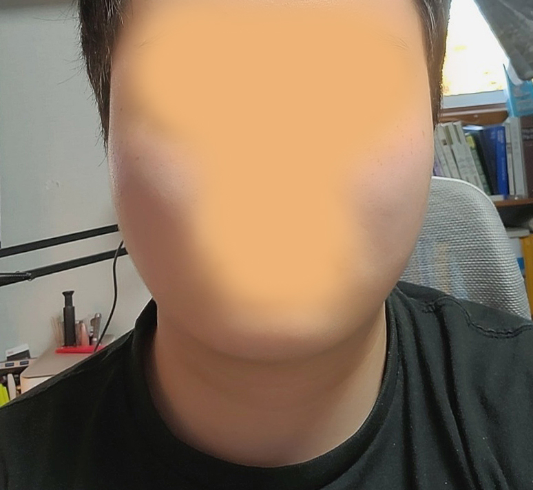 주변에서 살빠졌냐고 묻네요~