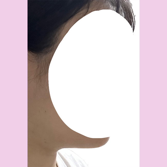 이중턱지흡 바이브 500%강추!!