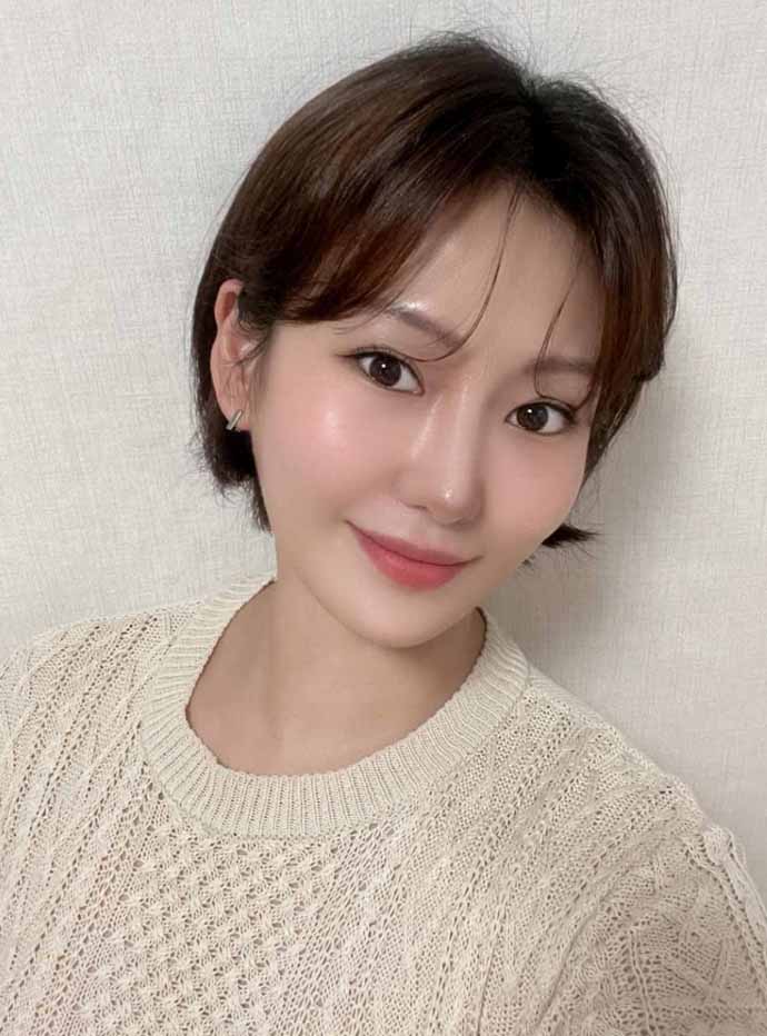 코성형 3개월차 후기