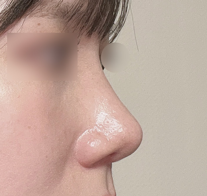 사후관리도 꼼꼼히 해주세요!!모양두 만죠옥~~