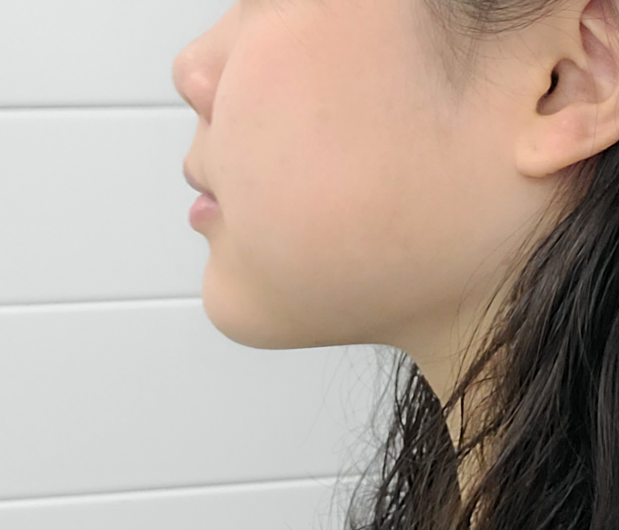 운동해도 안빠진 이중턱 얼지흡으로 이별한 후기ㅋㅋ