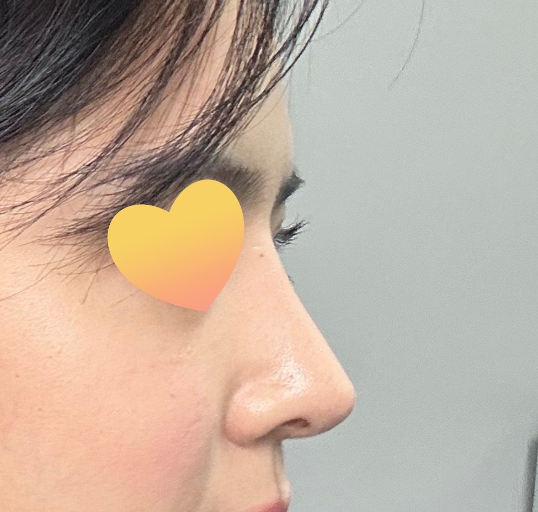 니즈에 맞게 해주셨어요(코6개월차!)