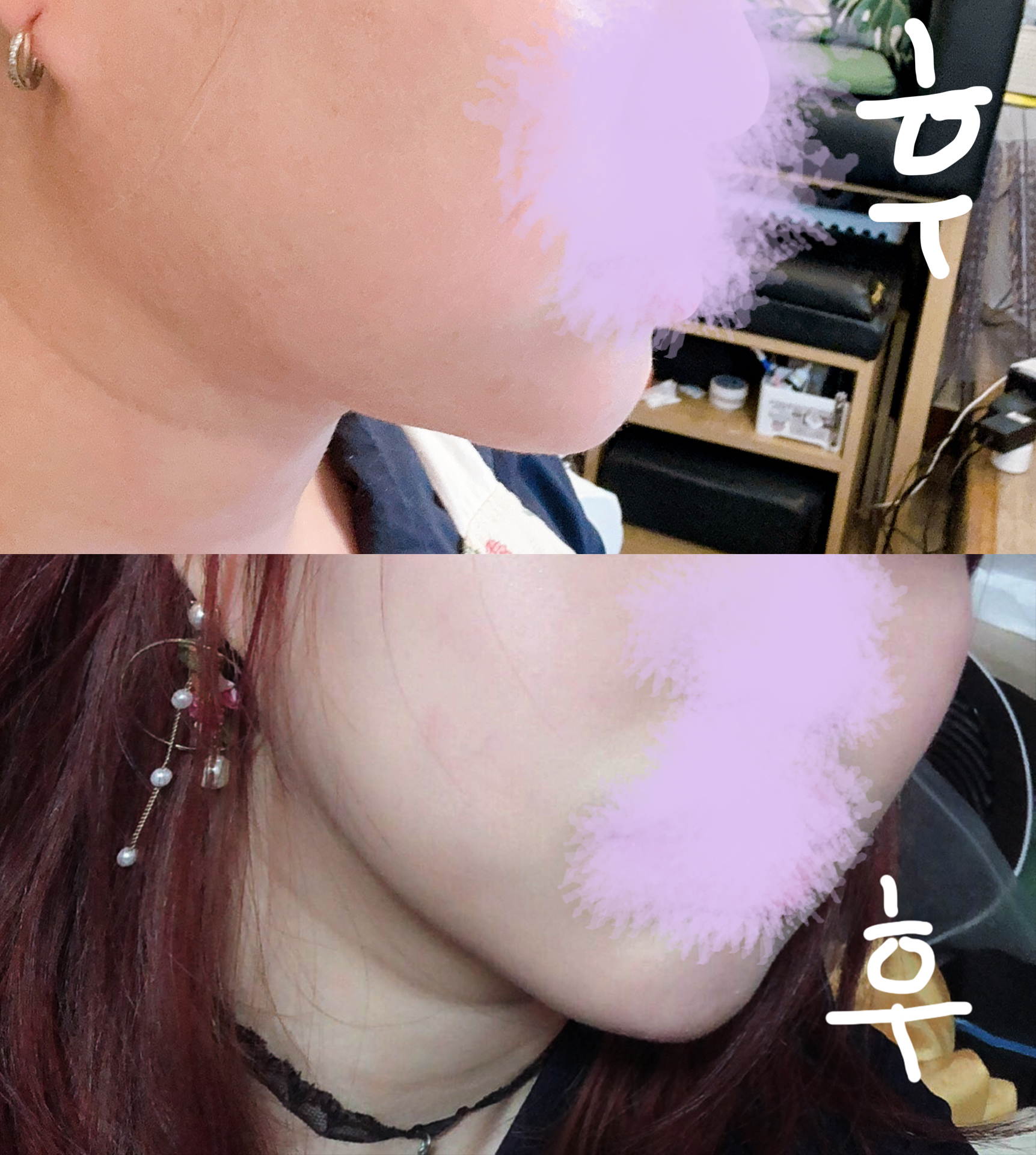 지흡하니까 숨겨졌던 목라인이 보여요ㅋ_ㅋ