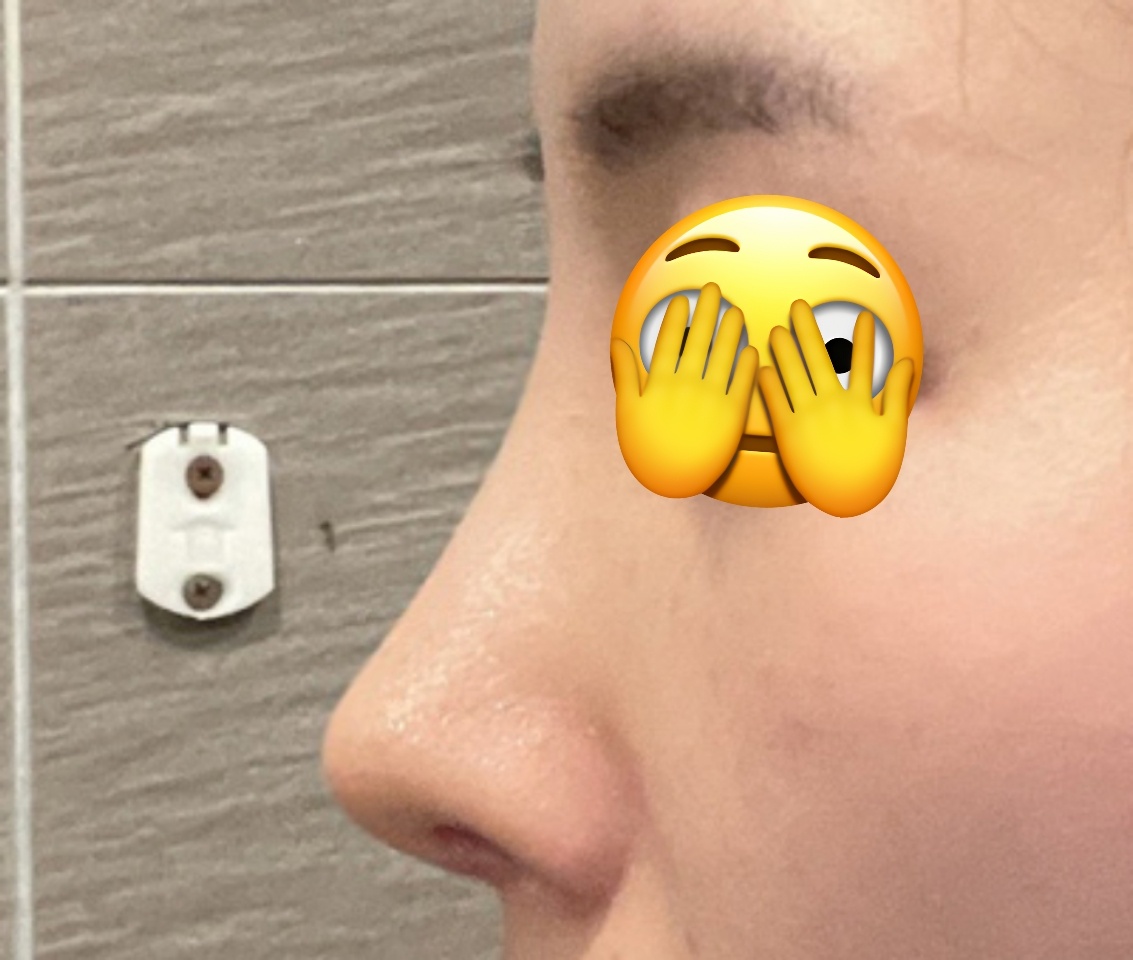 9군데발품팔고 바이브선택해서 코해써요