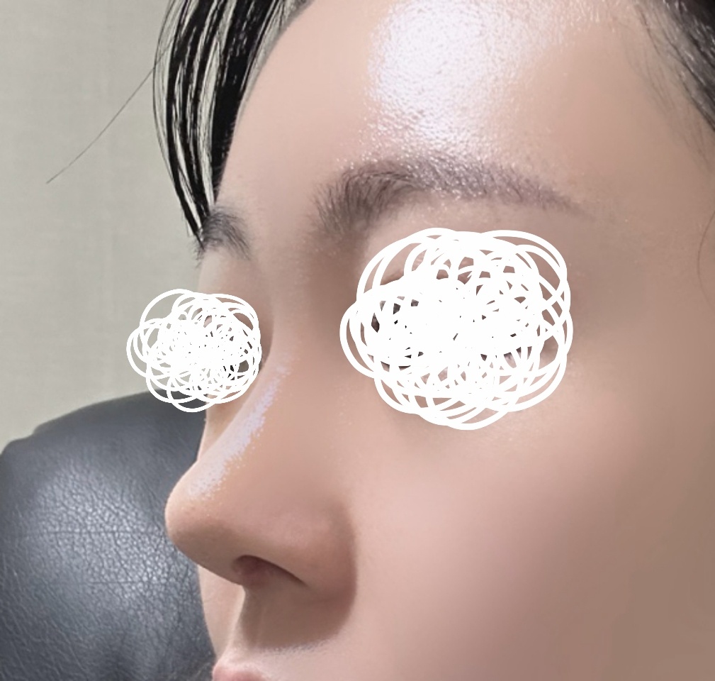 눈/코/이마거상 3주차됐숨다