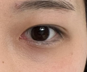 유영문 원장님 실력 너무 좋은듯