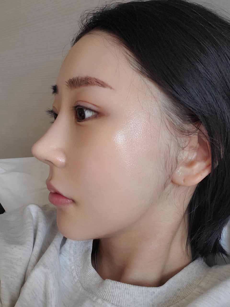 눈,코 재수술한지 한달ㅎㅎ