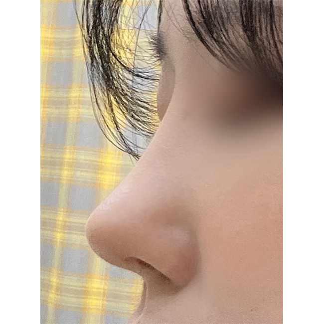 벌써7개월차!! 쭉 만족중