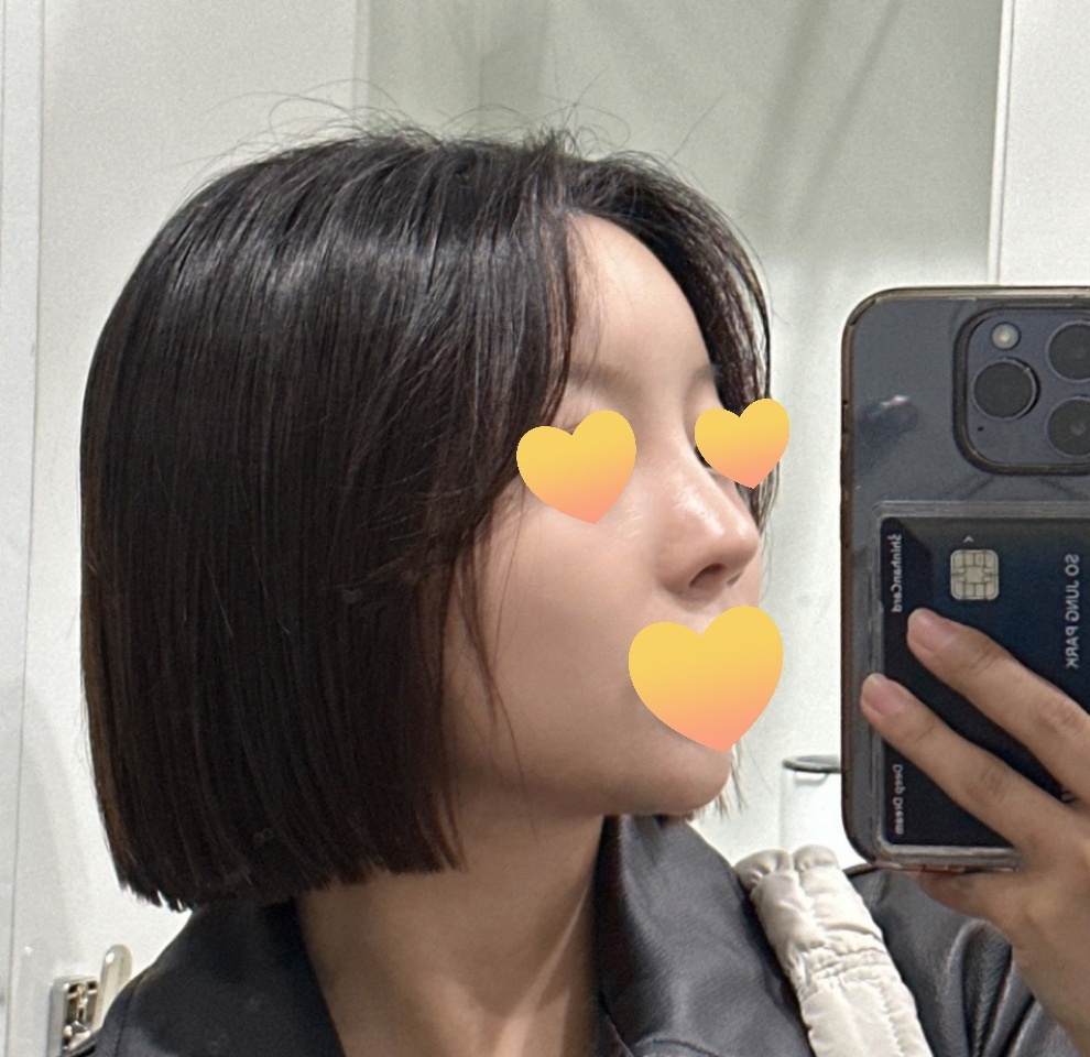 유영문원장님께 맡기길 잘한거같아용><