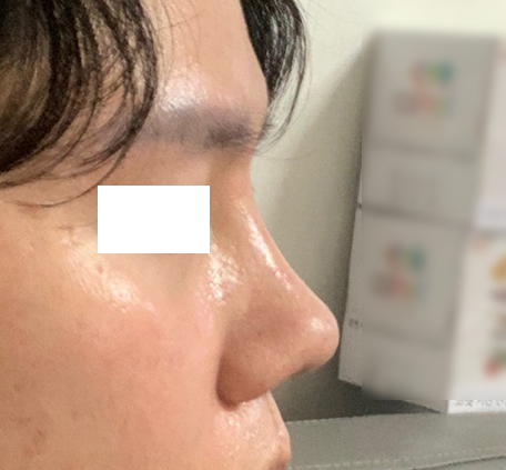 코했는데 자연스럽고 원래 제코 같아요!