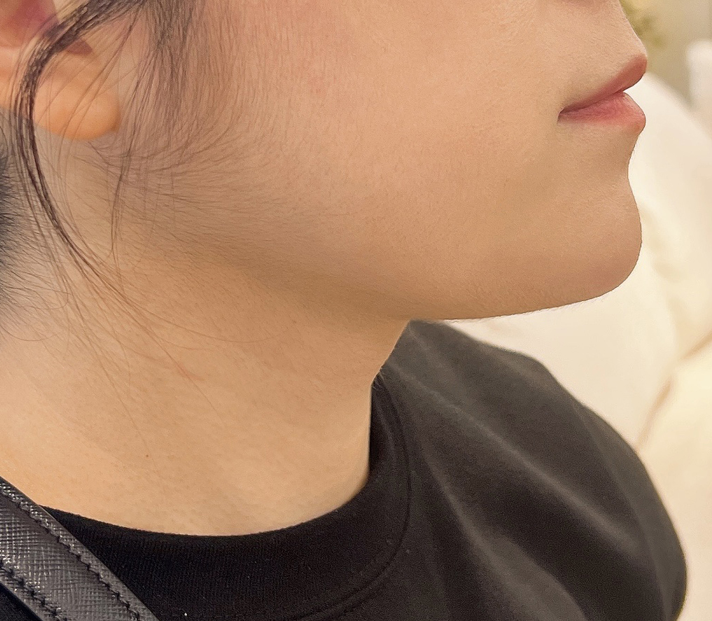 얼지흡한지 3개월지나가요!효과굿뜨!