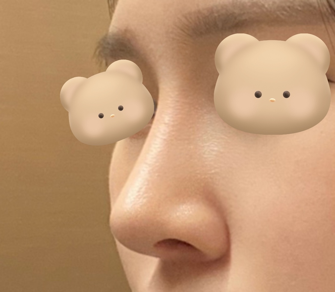 자연스럽게 코 잘됐어용