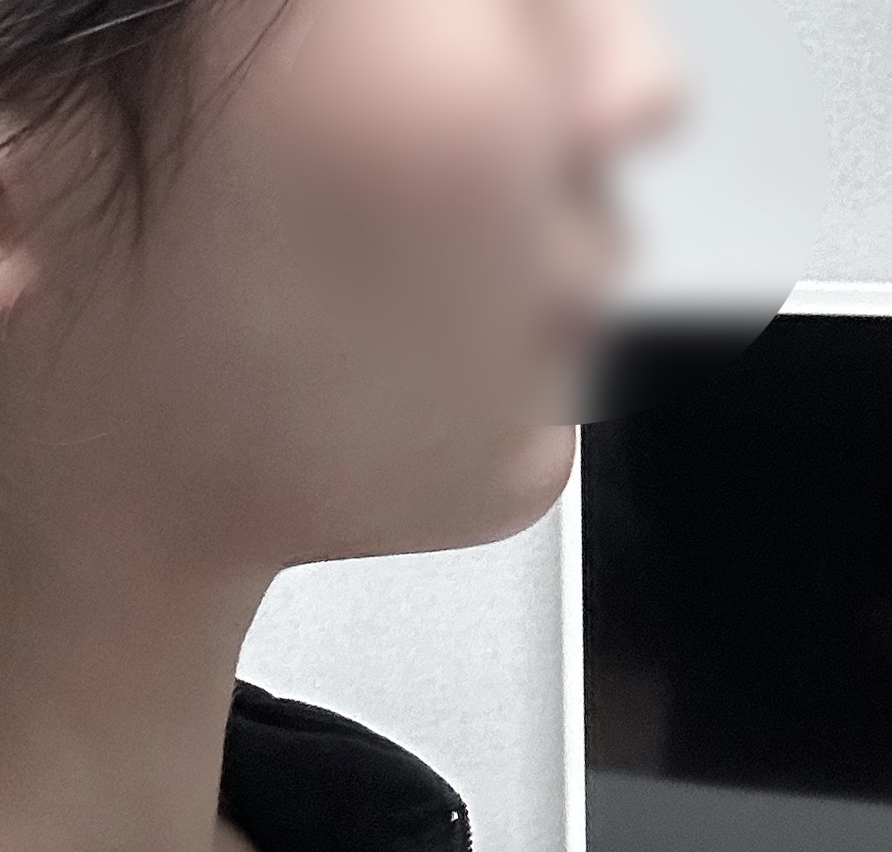 전보다 갸름갸름해졌습니닷~얼지흡효과굿