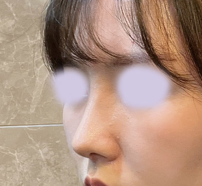 코 더 일찍할걸하는 후회뿐!