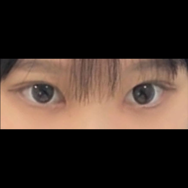 쌍테, 쌍액 이제 안하니 넘좋아요 ㅠ 라인넘만족