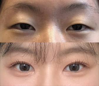 자연스럽게 자리잡아서 매우 만족 ㅎㅎ