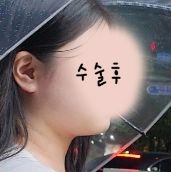 얼지흡 증말 올해 잘한 일이라 생각해요:)