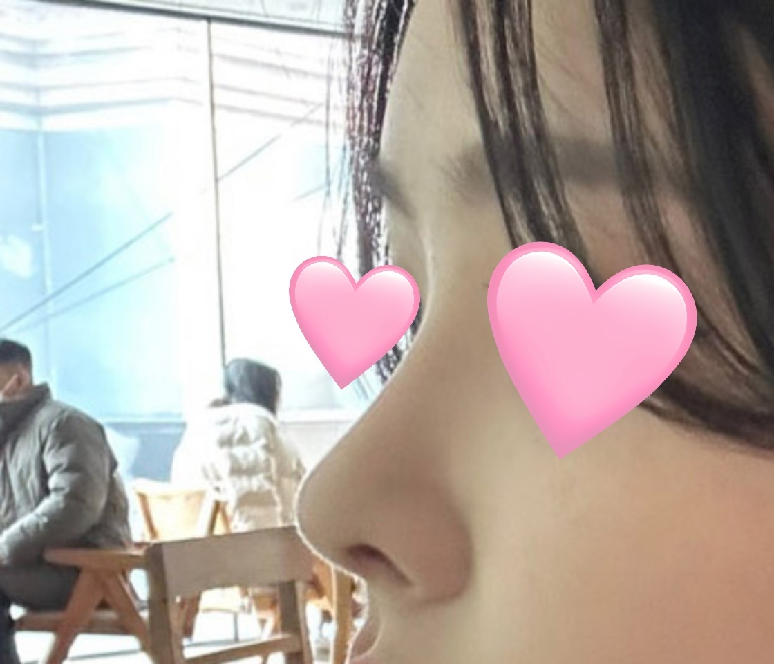 이목구비가 뚜렷해져서 넘 좋아요ㅎㅎ