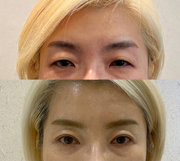 10년은 더 젊어지고 예뻐졌어요~^^