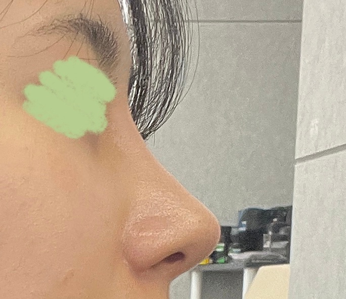 코 너무 잘된거같아요!!!굿